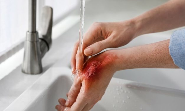 Cedera Jaringan Kulit Atau Seperti Luka Bakar