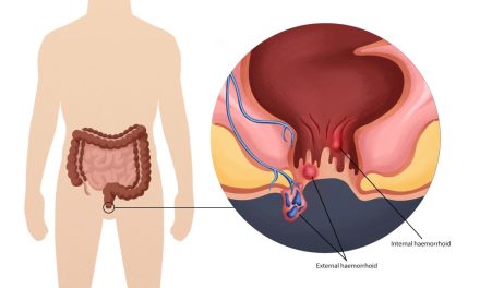 Penyakit Bagian Belakang Atau Anus Ambeyen